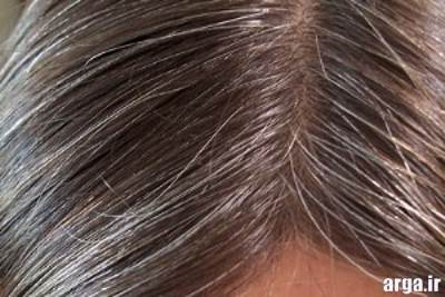 جلوگیری از سفید شدن مو