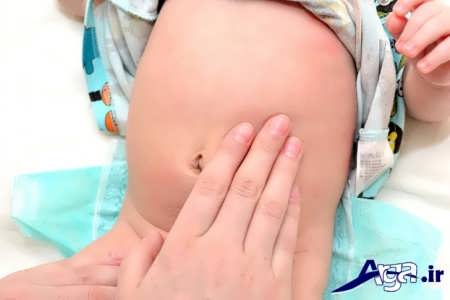 درمان کار نکردن شکم نوزاد