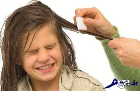 درمان شپش سر در کودکان
