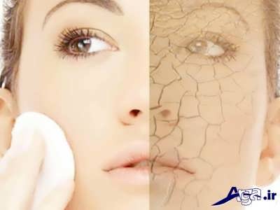 ماسک های مفید برای رفع خشکی پوست 