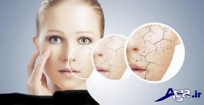 معرفی انواع ماسک های خانگی برای درمان پوست خشک 