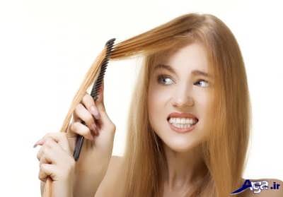 روش های درمان طبیعی ریزش مو