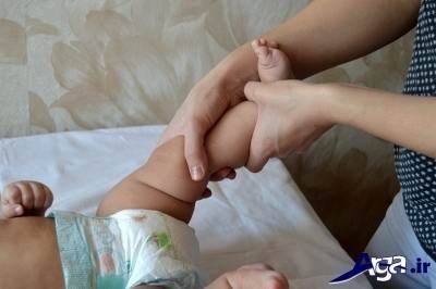  درمان پای پرانتزی در کودکان