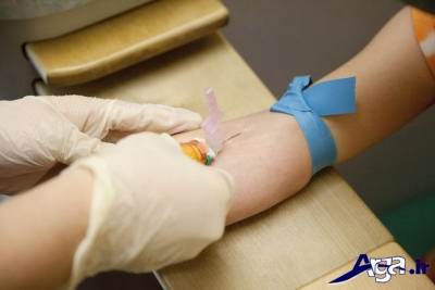 انواع آزمایش خون بارداری