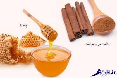 درمان سینوزیت با دارچین و عسل