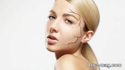 روش های خانگی و طبیعی درمان خشکی پوست