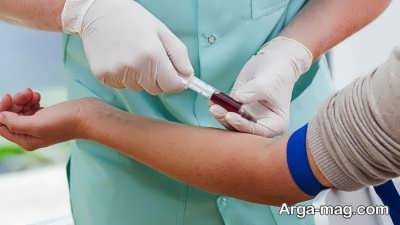 Signs-of-anemia-3.jpg