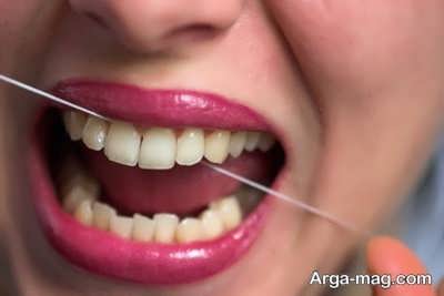 درمان عفونت لثه و دندان 