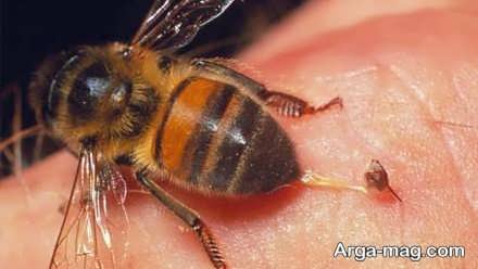 درمان زنبور گزیدگی