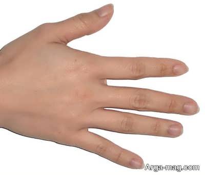 درمان تخصصی درد انگشتان دست 