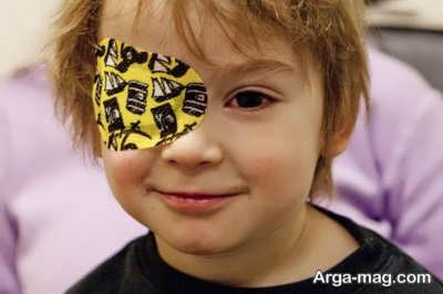 علت به وجود آمدن تنبلی چشم در کودکان چیست؟ 