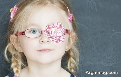 چگونه از تنبلی چشم در کودکان آگاه شویم؟ 