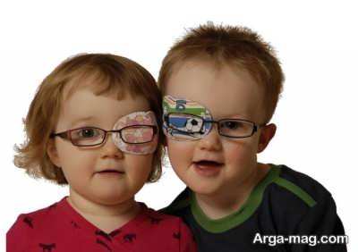 راه های درمان تنبلی چشم در کودکان 