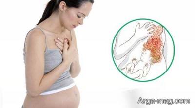 رراه های درمان طبیعی سوزش معده در بارداری