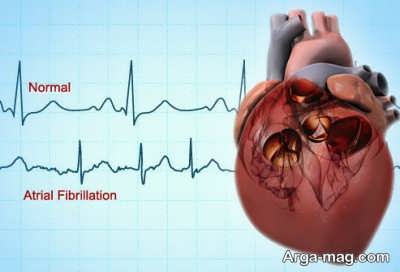 چه هنگامی باید برای تشخیص بیماری قلبی به پزشک مراجعه کرد؟