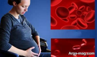 دانستنی های مهم در مورد کم خونی در بارداری