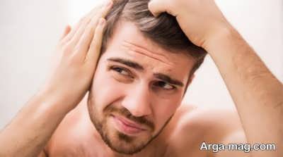 هر آنچه لازم است از علل ریزش مو تا درمان بدانید