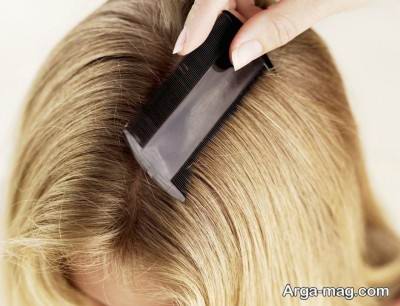 راه های درمان شپش موی سر