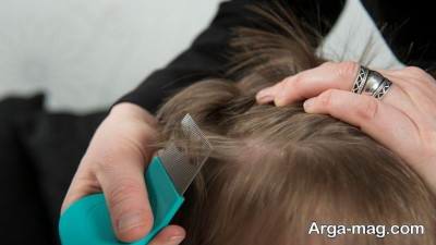 راه و روش درمان شپش موی سر