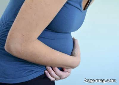 زمان مراجعه به پزشک به خاطر درد دور ناف در بارداری را بشناسید