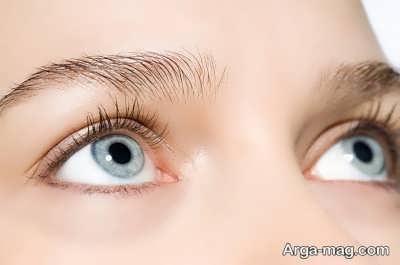 راه های درمانی موثر در رفع کبودی زیر چشم