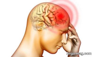 درمان های دارویی و خانگی سردرد بالای سر