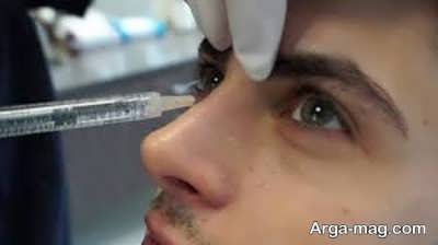 تزریق ژل برای رفع گودی چشم
