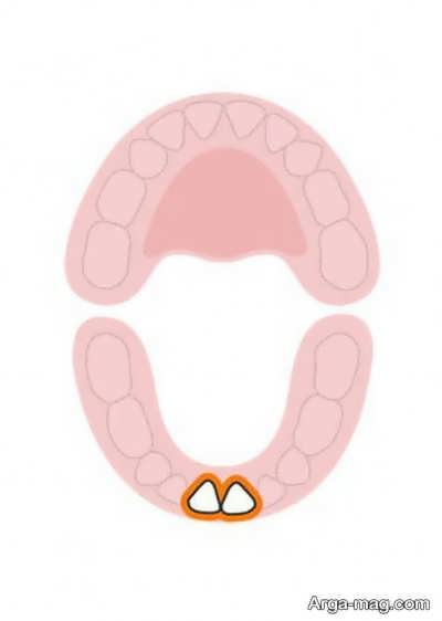 دندان های کودکان