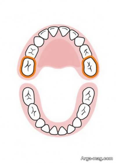 دندان های کودکان