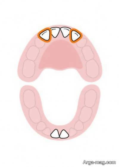 دندان های کودکان