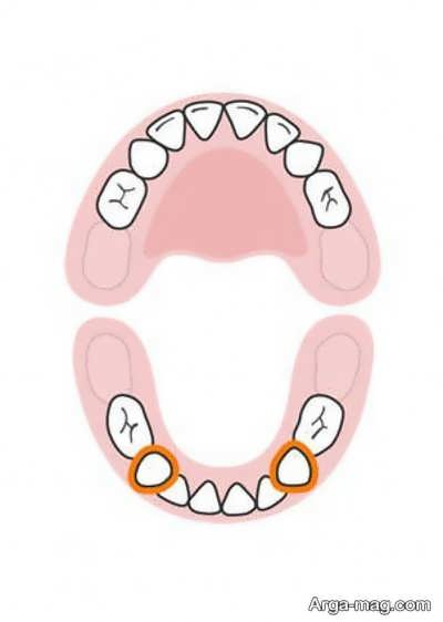 دندان های کودکان