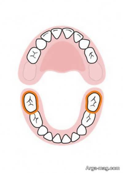 دندان های کودکان