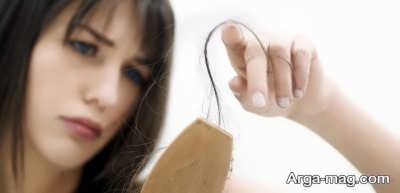 ریزش موی سر در زنان پس از زایمان
