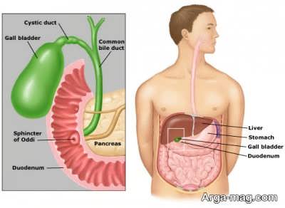 درد کیسه صفرا