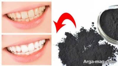 تمیزی دندان با زغال فعال