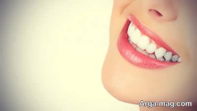 اصلاح طرح لبخند با سفیدی دندان ها