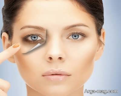 درمان های طبیعی برای گودی کاسه چشم 
