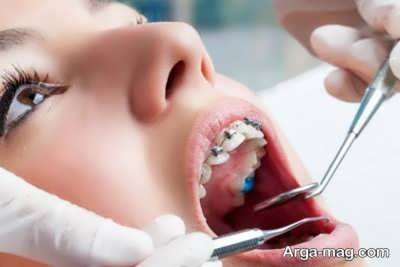 مراحل سیم کشی دندان