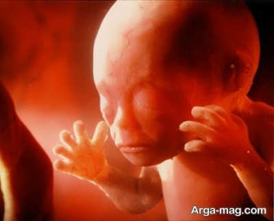 تعبیر دیدن سقط جنین در عالم رویا 