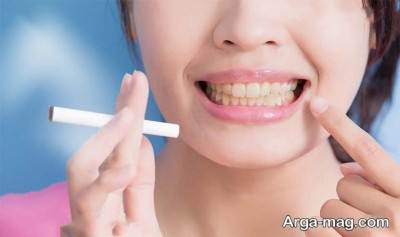 روش های خانگی جلوگیری تز زرد شدن دندان