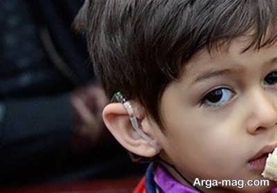 درمان ناشنوایی کودکان با کاشت حلزون