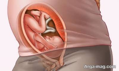 هر آنچه باید در مورد این دوره از بارداری بدانید