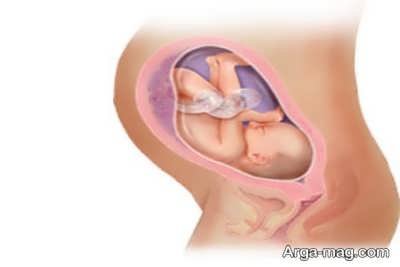وضعیت مادر در هفته سی بارداری