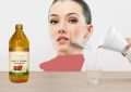 از بین بردن جای جوش با روش های طبیعی و خانگی