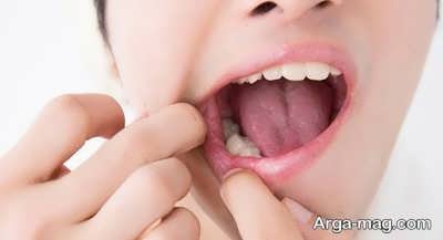 درمان دندان درد با روش های طبیعی