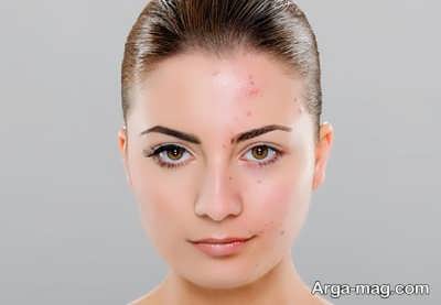 خواص لیمو شیرین بر سلامت پوست