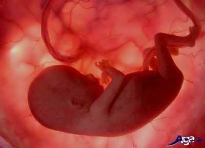 نشانه ها و علائم سقط جنین 