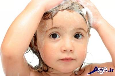 روش درمانی ریزش مو کودکان