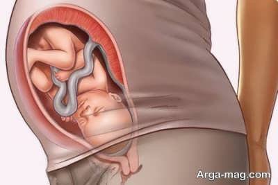 کاهش حرکت جنین در بارداری