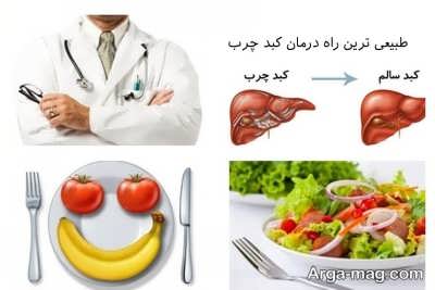 باید ها و نبایدها در رژیم غذایی برای کبد چرب